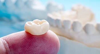 A close-up of a dental crown sitting on a person’s finger